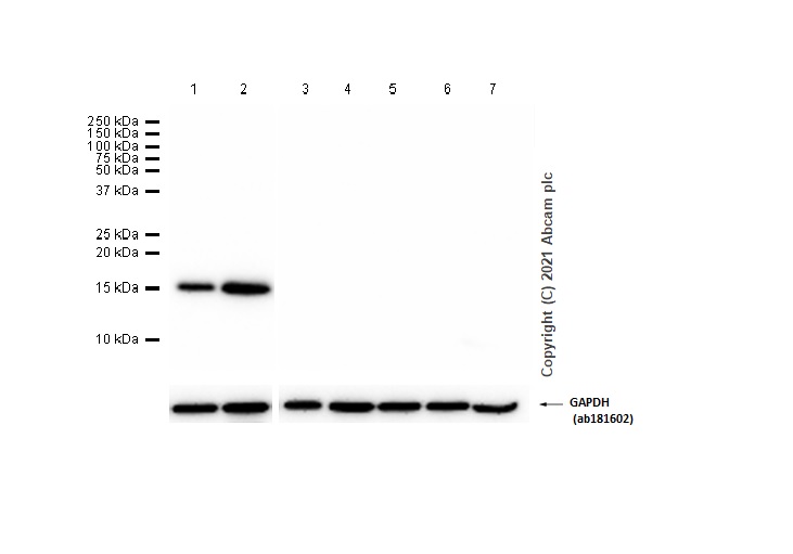 Western blot - Anti-C1D antibody [EPR11122] (AB166897), expandable thumbnail