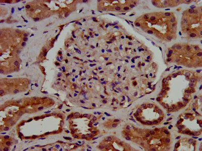 Immunohistochemistry (Formalin/PFA-fixed paraffin-embedded sections) - Anti-C1GALT1 antibody (AB237734)