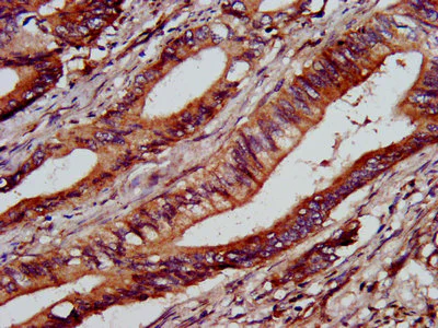 Immunohistochemistry (Formalin/PFA-fixed paraffin-embedded sections) - Anti-C1GALT1 antibody (AB237734)