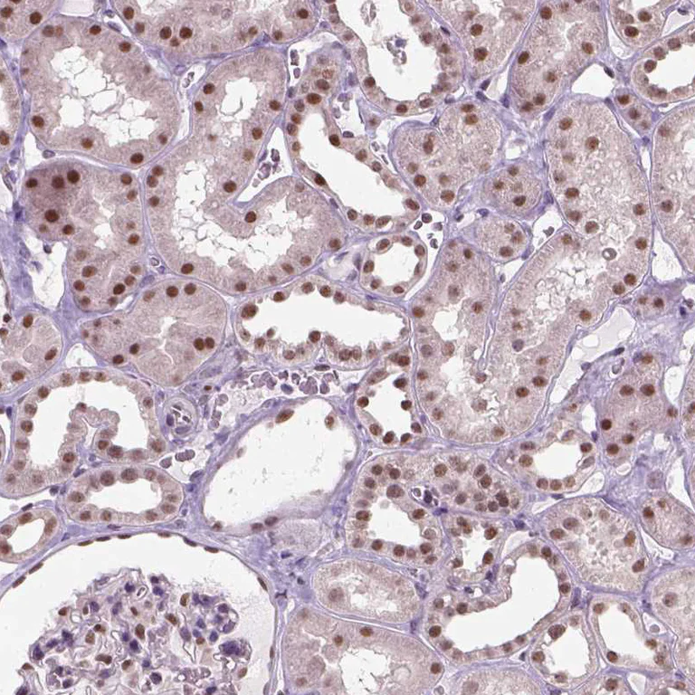 Immunohistochemistry (Formalin/PFA-fixed paraffin-embedded sections) - Anti-C1orf112 antibody (AB121774)