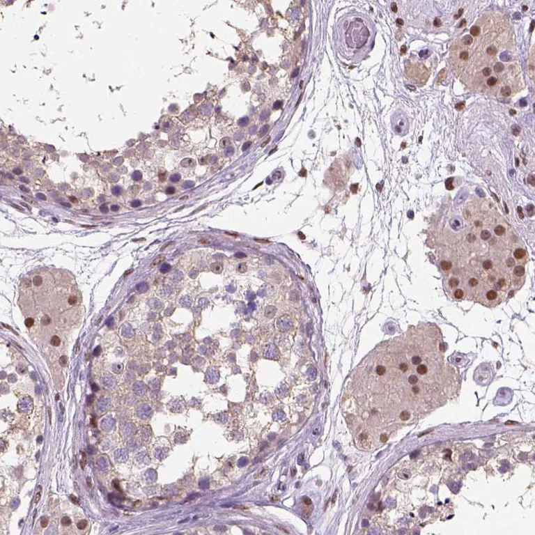 Immunohistochemistry (Formalin/PFA-fixed paraffin-embedded sections) - Anti-C1orf112 antibody (AB121774)