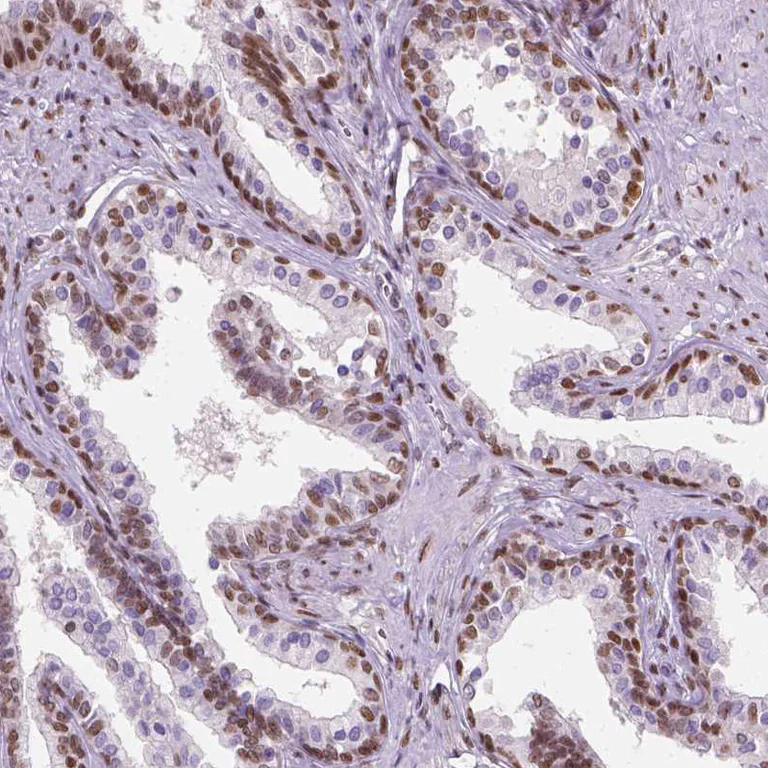 Immunohistochemistry (Formalin/PFA-fixed paraffin-embedded sections) - Anti-C1orf112 antibody (AB121774)
