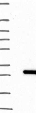 Western blot - Anti-C1orf123 antibody (AB122865), expandable thumbnail