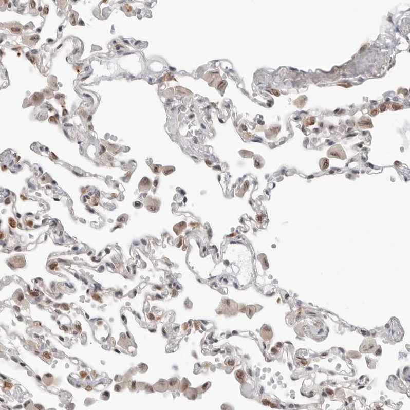Immunohistochemistry (Formalin/PFA-fixed paraffin-embedded sections) - Anti-C1orf162 antibody (AB121903), expandable thumbnail