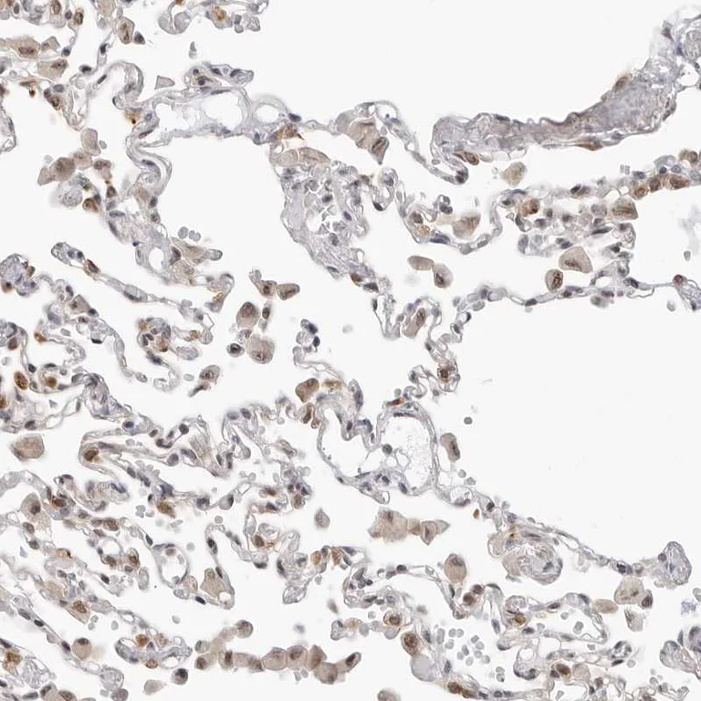 Immunohistochemistry (Formalin/PFA-fixed paraffin-embedded sections) - Anti-C1orf162 antibody (AB121903)