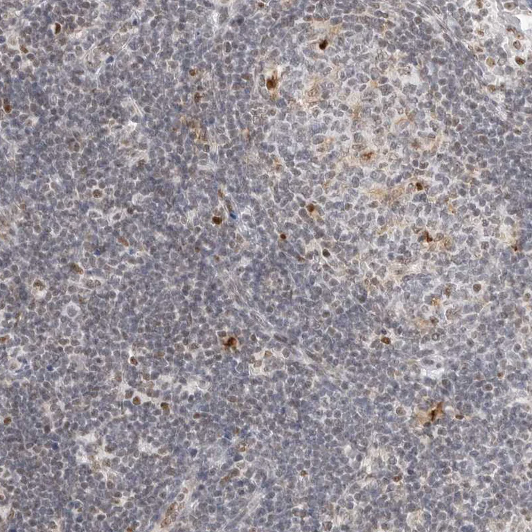 Immunohistochemistry (Formalin/PFA-fixed paraffin-embedded sections) - Anti-C1orf162 antibody (AB121903)