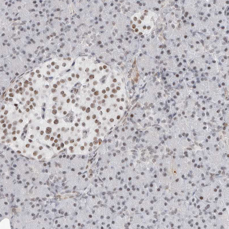 Immunohistochemistry (Formalin/PFA-fixed paraffin-embedded sections) - Anti-C1orf162 antibody (AB121903), expandable thumbnail