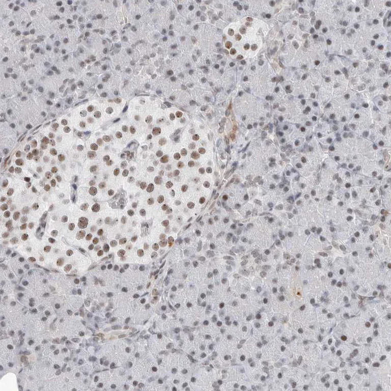 Immunohistochemistry (Formalin/PFA-fixed paraffin-embedded sections) - Anti-C1orf162 antibody (AB121903)
