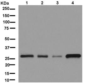 Western blot - Anti-C1orf163 antibody [EPR13779-38] (AB181179), expandable thumbnail