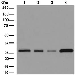 Western blot - Anti-C1orf163 antibody [EPR13779-38] (AB181179)