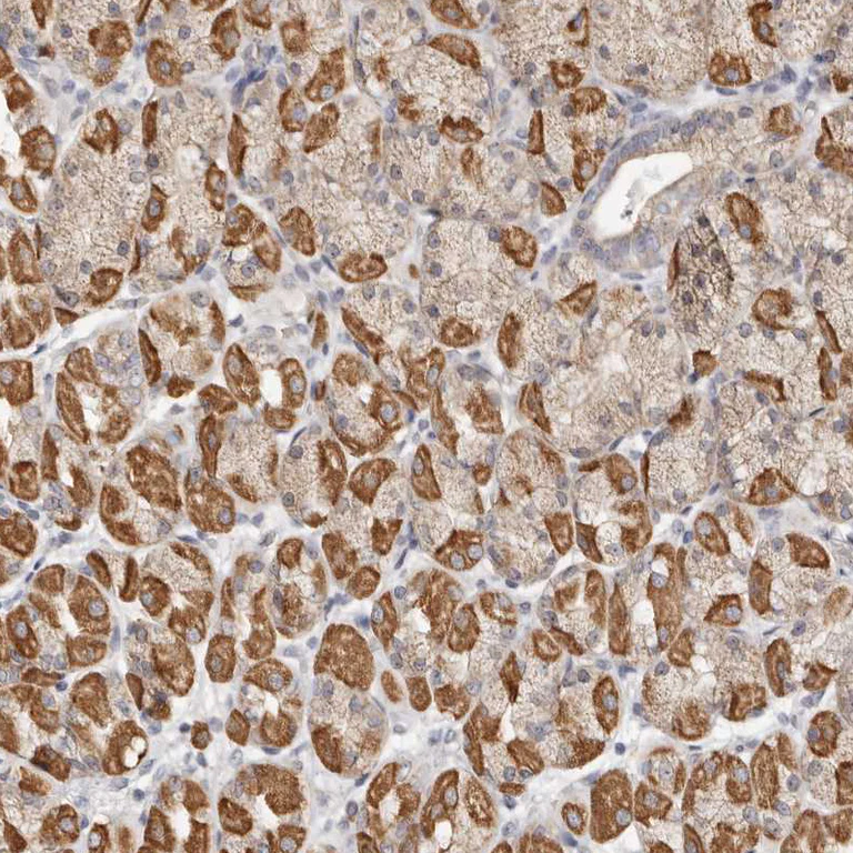 Immunohistochemistry (Formalin/PFA-fixed paraffin-embedded sections) - Anti-C1orf172 antibody (AB224760)