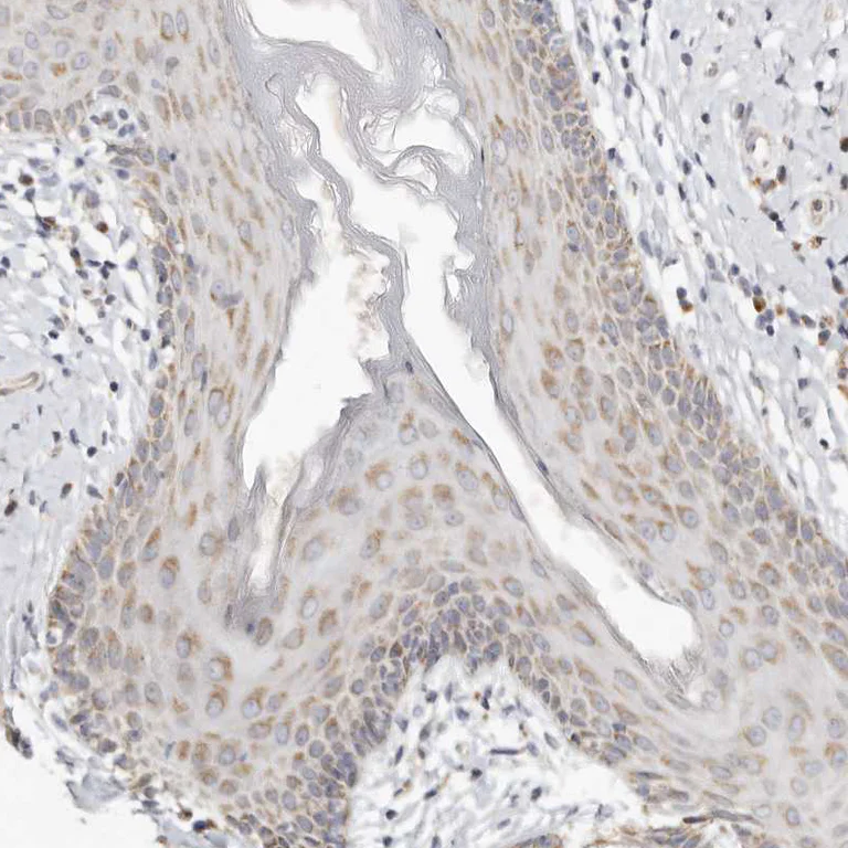 Immunohistochemistry (Formalin/PFA-fixed paraffin-embedded sections) - Anti-C1orf172 antibody (AB224760)