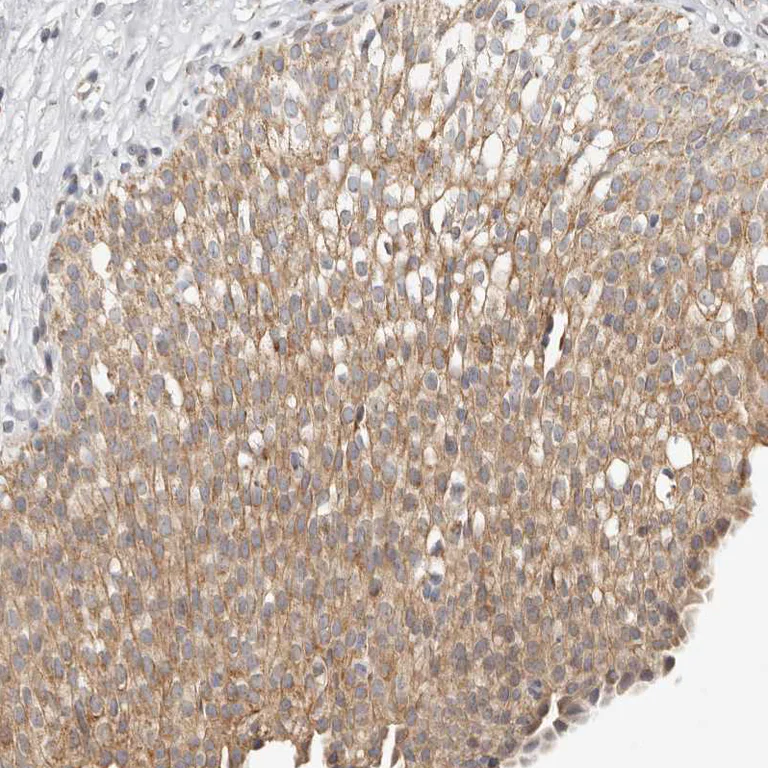 Immunohistochemistry (Formalin/PFA-fixed paraffin-embedded sections) - Anti-C1orf172 antibody (AB224760)