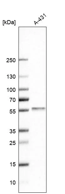 Western blot - Anti-C1orf172 antibody (AB224760)