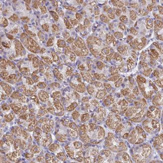 Immunohistochemistry (Formalin/PFA-fixed paraffin-embedded sections) - Anti-C1orf192 antibody (AB126543)