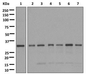 Western blot - Anti-C1orf69/IBA57 antibody [EPR11758(2)] - BSA and Azide free (AB250166), expandable thumbnail
