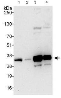 Western blot - Anti-C1orf77/FOP antibody (AB123603)