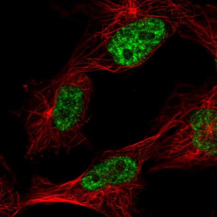 Immunocytochemistry/ Immunofluorescence - Anti-C1orf77/FOP antibody (AB220086)