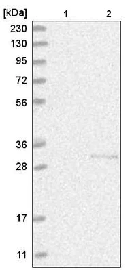Western blot - Anti-C1orf77/FOP antibody (AB220086)