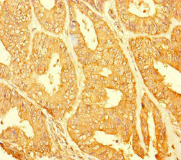 Immunohistochemistry (Formalin/PFA-fixed paraffin-embedded sections) - Anti-C1orf77/FOP antibody (AB222861)