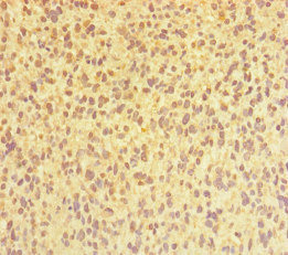 Immunohistochemistry (Formalin/PFA-fixed paraffin-embedded sections) - Anti-C1orf77/FOP antibody (AB222861)