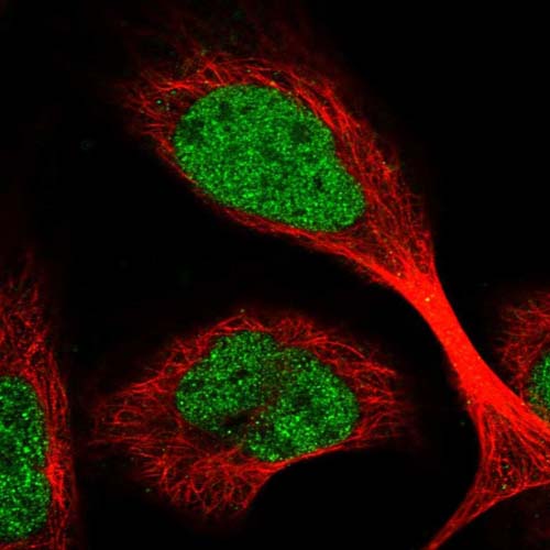 Immunocytochemistry/ Immunofluorescence - Anti-C1orf86 antibody (AB122511), expandable thumbnail