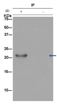 Immunoprecipitation - Anti-C1orf93 antibody [EPR13703] - BSA and Azide free (AB250265), expandable thumbnail