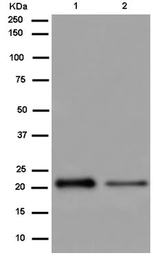 Western blot - Anti-C1orf93 antibody [EPR13703] - BSA and Azide free (AB250265)