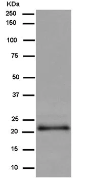 Western blot - Anti-C1orf93 antibody [EPR13703] - BSA and Azide free (AB250265)