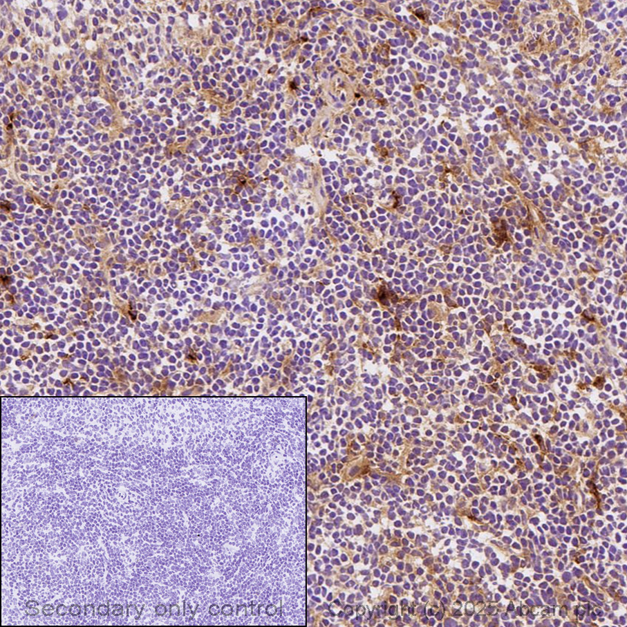 Anti-C1q antibody [4.8]