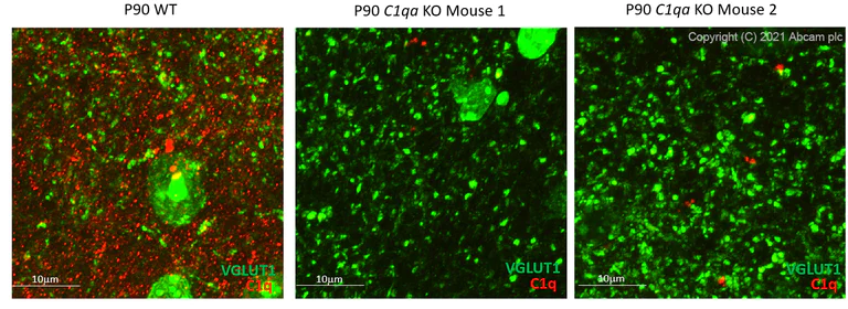 Immunohistochemistry (Frozen sections) - Anti-C1q antibody [7H8] (AB11861)