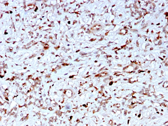 Immunohistochemistry (Formalin/PFA-fixed paraffin-embedded sections) - Anti-C1q antibody [C1QA/2956] (AB268120)