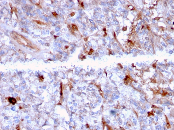 Immunohistochemistry (Formalin/PFA-fixed paraffin-embedded sections) - Anti-C1q antibody [C1QA/2956] (AB268120), expandable thumbnail