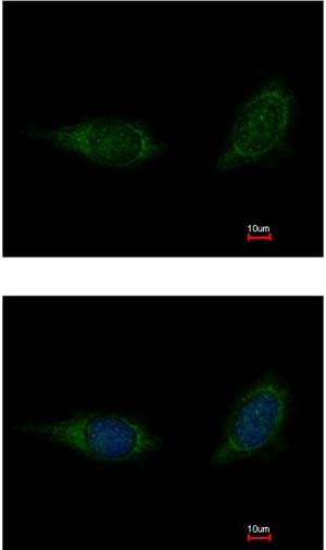 Immunocytochemistry/ Immunofluorescence - Anti-C1QA antibody (AB155052), expandable thumbnail