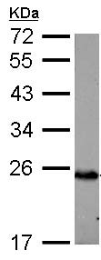 Western blot - Anti-C1QA antibody (AB155052), expandable thumbnail