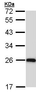 Western blot - Anti-C1QA antibody (AB155052), expandable thumbnail