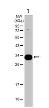 Western blot - Anti-C1QA antibody (AB155052)