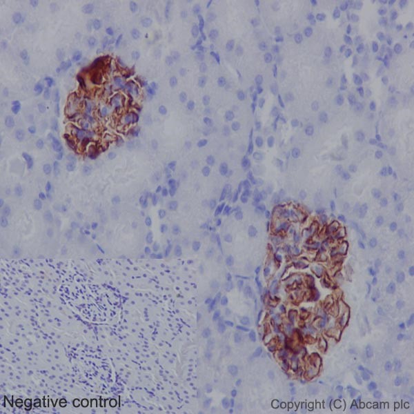 Immunohistochemistry (Formalin/PFA-fixed paraffin-embedded sections) - Anti-C1QA antibody [EPR14634] (AB189922), expandable thumbnail