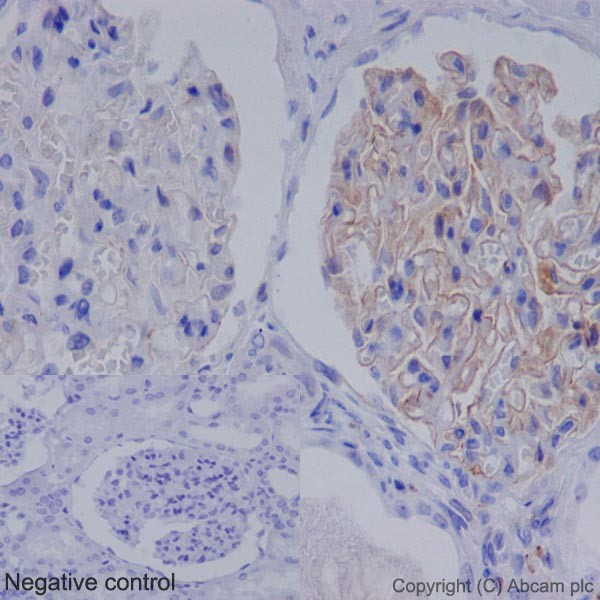 Immunohistochemistry (Formalin/PFA-fixed paraffin-embedded sections) - Anti-C1QA antibody [EPR14634] (AB189922), expandable thumbnail