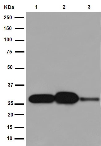 Western blot - Anti-C1QA antibody [EPR14634] (AB189922), expandable thumbnail