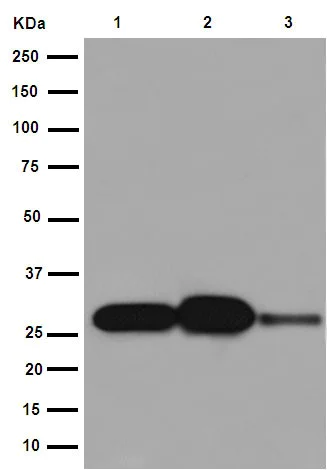 Western blot - Anti-C1QA antibody [EPR14634] (AB189922)