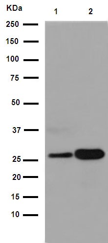 Western blot - Anti-C1QA antibody [EPR14634] (AB189922), expandable thumbnail