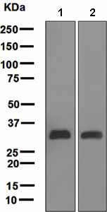 Western blot - Anti-C1QA antibody [EPR2979(2)] (AB108325), expandable thumbnail