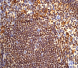 Immunohistochemistry (Formalin/PFA-fixed paraffin-embedded sections) - Anti-C1QA antibody [EPR2980Y] (AB76425), expandable thumbnail