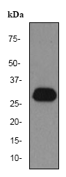 Western blot - Anti-C1QA antibody [EPR2980Y] (AB76425), expandable thumbnail
