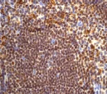 Immunohistochemistry (Formalin/PFA-fixed paraffin-embedded sections) - Anti-C1QA antibody [EPR2980Y] - BSA and Azide free (AB247472)