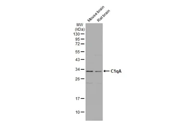 Western blot - Anti-C1qA antibody [HL1695] (AB308185)