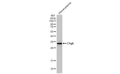 Western blot - Anti-C1qA antibody [HL1695] (AB308185)