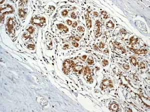 Immunohistochemistry (Formalin/PFA-fixed paraffin-embedded sections) - Anti-C1QB antibody [EPR2981] (AB92508)