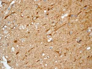 Immunohistochemistry (Formalin/PFA-fixed paraffin-embedded sections) - Anti-C1QB antibody [EPR2981] - BSA and Azide free (AB247575), expandable thumbnail